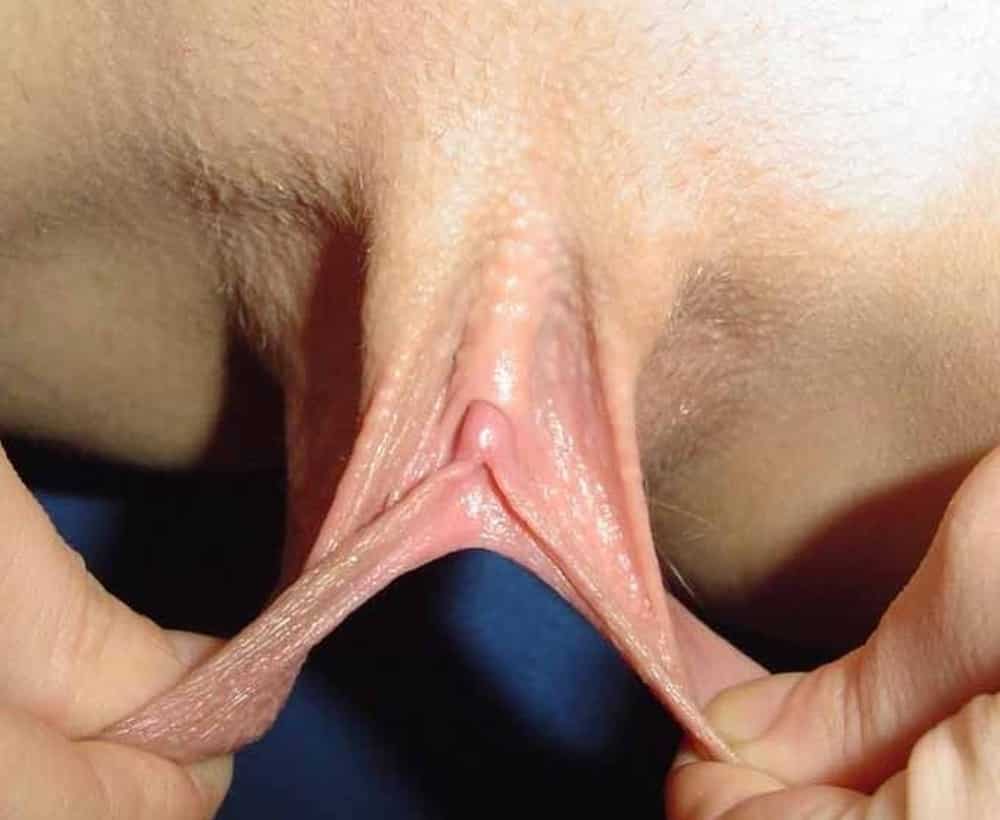 Schamlippen hängen aus Vagina.